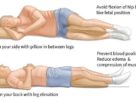 best sleeping position for peripheral artery disease