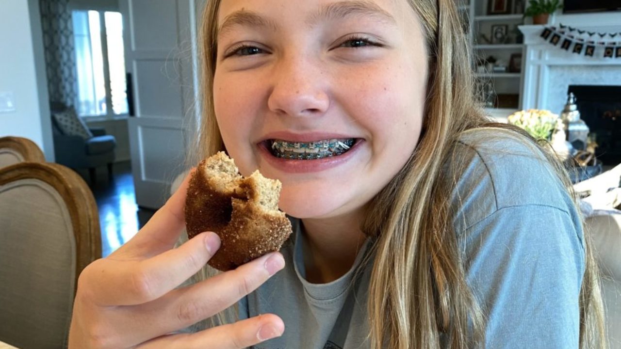 what to eat with braces the first week